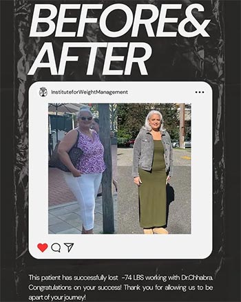 Patient Success Stories at The Institute of Weight Management and Wellness in Hackensack, NJ