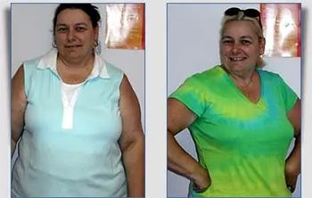 Patient Success Stories at The Institute of Weight Management and Wellness in Hackensack, NJ
