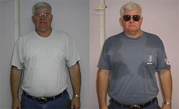 Patient Success Stories at The Institute of Weight Management and Wellness in Hackensack, NJ