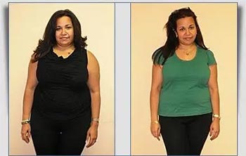 Patient Success Stories at The Institute of Weight Management and Wellness in Hackensack, NJ