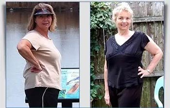 Patient Success Stories at The Institute of Weight Management and Wellness in Hackensack, NJ