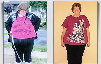 Patient Success Stories at The Institute of Weight Management and Wellness in Hackensack, NJ
