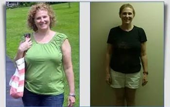 Patient Success Stories at The Institute of Weight Management and Wellness in Hackensack, NJ