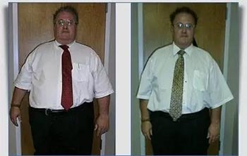 Patient Success Stories at The Institute of Weight Management and Wellness in Hackensack, NJ