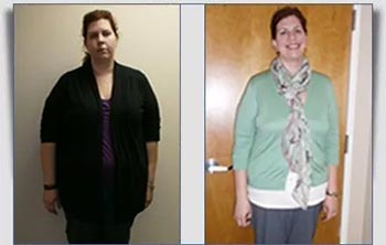 Patient Success Stories at The Institute of Weight Management and Wellness in Hackensack, NJ