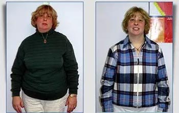 Patient Success Stories at The Institute of Weight Management and Wellness in Hackensack, NJ