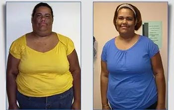 Patient Success Stories at The Institute of Weight Management and Wellness in Hackensack, NJ