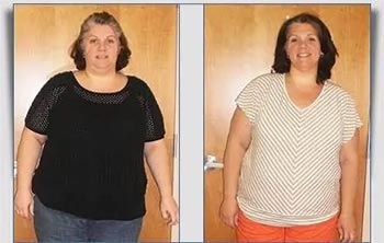 Patient Success Stories at The Institute of Weight Management and Wellness in Hackensack, NJ