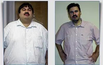 Patient Success Stories at The Institute of Weight Management and Wellness in Hackensack, NJ