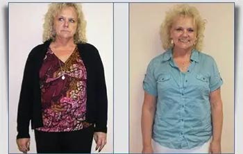 Patient Success Stories at The Institute of Weight Management and Wellness in Hackensack, NJ