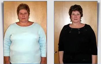 Patient Success Stories at The Institute of Weight Management and Wellness in Hackensack, NJ