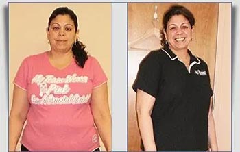 Patient Success Stories at The Institute of Weight Management and Wellness in Hackensack, NJ