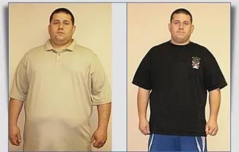 Patient Success Stories at The Institute of Weight Management and Wellness in Hackensack, NJ