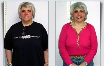 Patient Success Stories at The Institute of Weight Management and Wellness in Hackensack, NJ