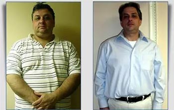 Patient Success Stories at The Institute of Weight Management and Wellness in Hackensack, NJ