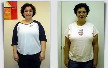 Patient Success Stories at The Institute of Weight Management and Wellness in Hackensack, NJ