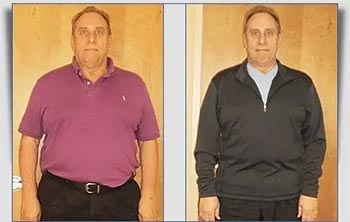 Patient Success Stories at The Institute of Weight Management and Wellness in Hackensack, NJ
