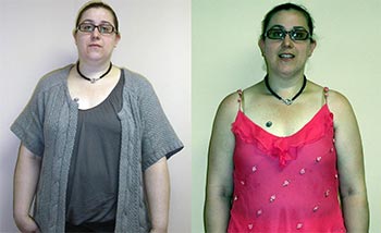 Patient Success Stories at The Institute of Weight Management and Wellness in Hackensack, NJ