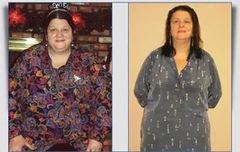 Patient Success Stories at The Institute of Weight Management and Wellness in Hackensack, NJ