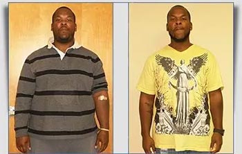 Patient Success Stories at The Institute of Weight Management and Wellness in Hackensack, NJ