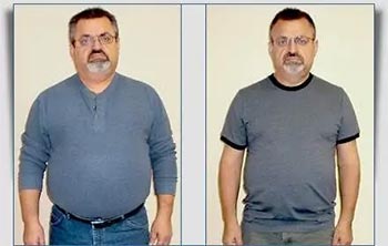 Patient Success Stories at The Institute of Weight Management and Wellness in Hackensack, NJ
