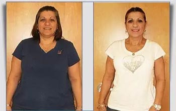 Patient Success Stories at The Institute of Weight Management and Wellness in Hackensack, NJ