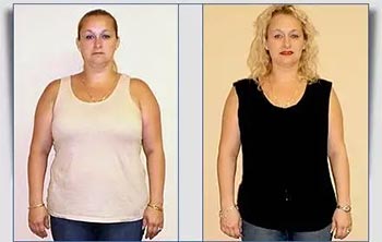 Patient Success Stories at The Institute of Weight Management and Wellness in Hackensack, NJ