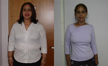Patient Success Stories at The Institute of Weight Management and Wellness in Hackensack, NJ