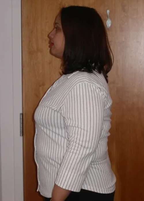 Frances Success Story at The Institute for Weight Management & Wellness in Hackensack, NJ