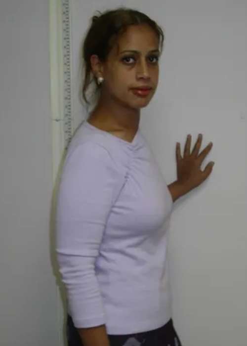 Frances Success Story at The Institute for Weight Management & Wellness in Hackensack, NJ