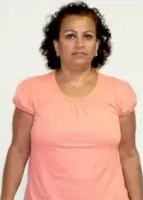 Gloria’s Success Story at The Institute for Weight Management & Wellness in Hackensack, NJ