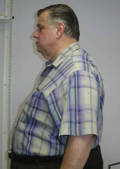 Harvey's Success Story at The Institute for Weight Management & Wellness in Hackensack, NJ Harvey's Success Story at The Institute for Weight Management & Wellness in Hackensack, NJ