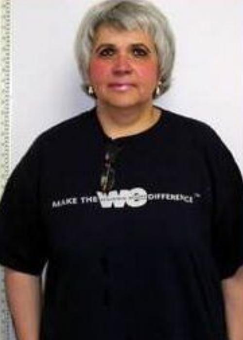 Jane’s Success Story at The Institute for Weight Management & Wellness in Hackensack, NJ