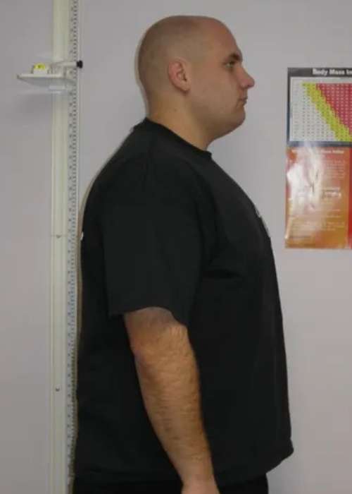 John's Success Story at The Institute for Weight Management & Wellness in Hackensack, NJ