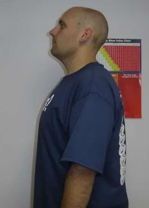 John's Success Story at The Institute for Weight Management & Wellness in Hackensack, NJ