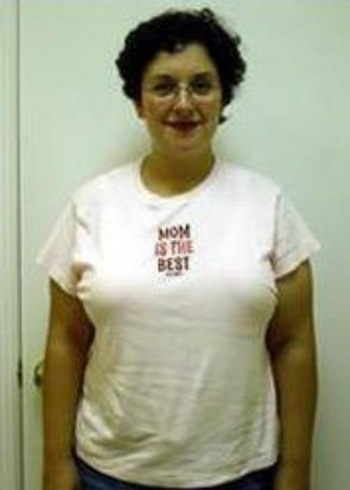 Julie’s Success Story at The Institute for Weight Management & Wellness in Hackensack, NJ