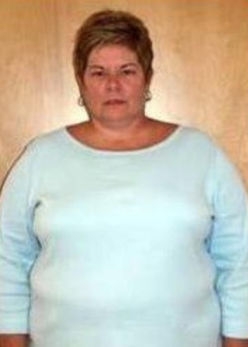 Kay Ann’s Success Story at The Institute for Weight Management & Wellness in Hackensack, NJ