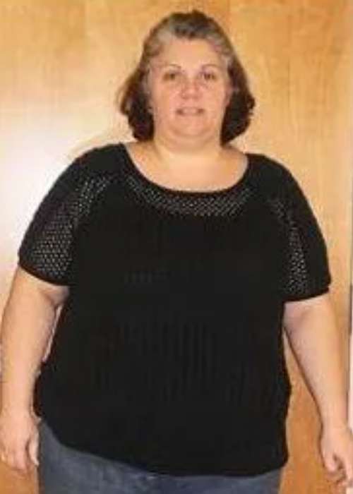 Lillian’s Success Story at The Institute for Weight Management & Wellness in Hackensack, NJ