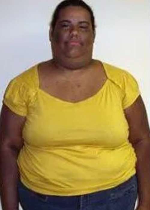 Luisanna’s Success Story at The Institute for Weight Management & Wellness in Hackensack, NJ