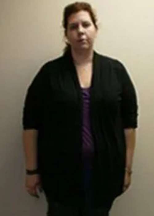 Mary Germano’s Success Story at The Institute for Weight Management & Wellness in Hackensack, NJ