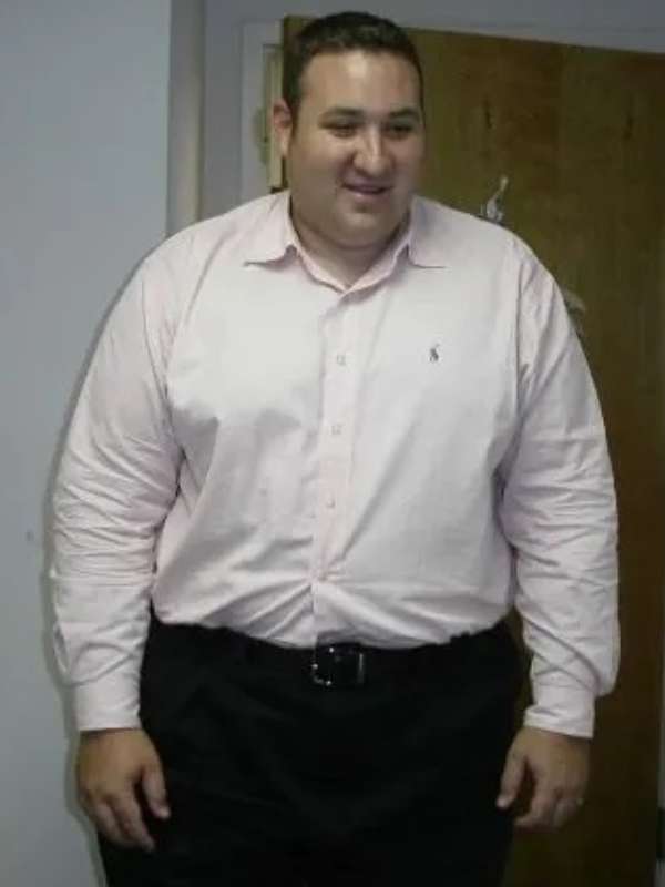 Mike's Success Story at The Institute for Weight Management & Wellness in Hackensack, NJ