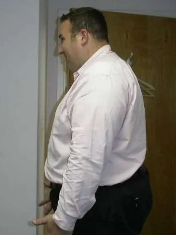 Mike's Success Story at The Institute for Weight Management & Wellness in Hackensack, NJ