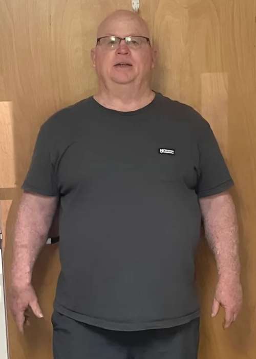 Nick Delcalzo's Success Story at The Institute for Weight Management & Wellness in Hackensack, NJ Nick Delcalzo's Success Story at The Institute for Weight Management & Wellness in Hackensack, NJ