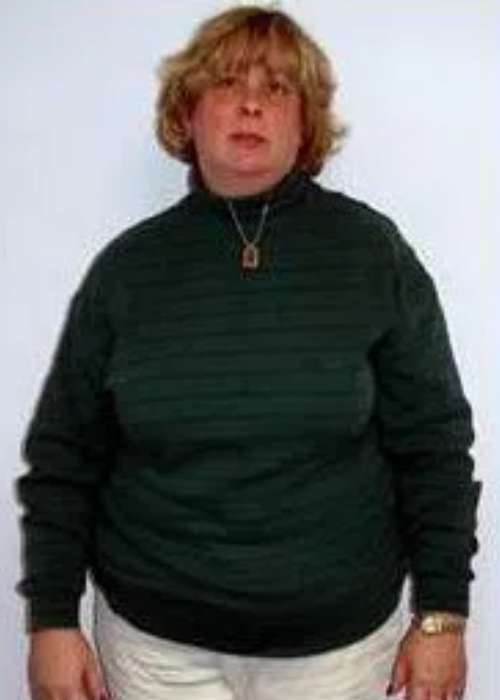 Patricia’s Success Story at The Institute for Weight Management & Wellness in Hackensack, NJ