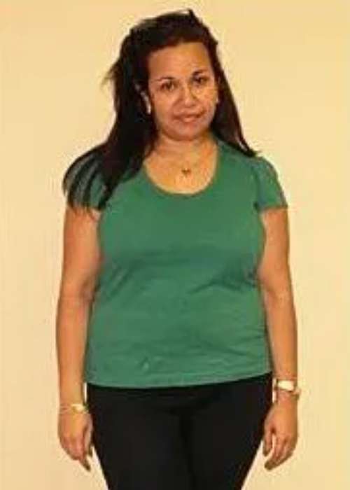 Rachel’s Success Story at The Institute for Weight Management & Wellness in Hackensack, NJ
