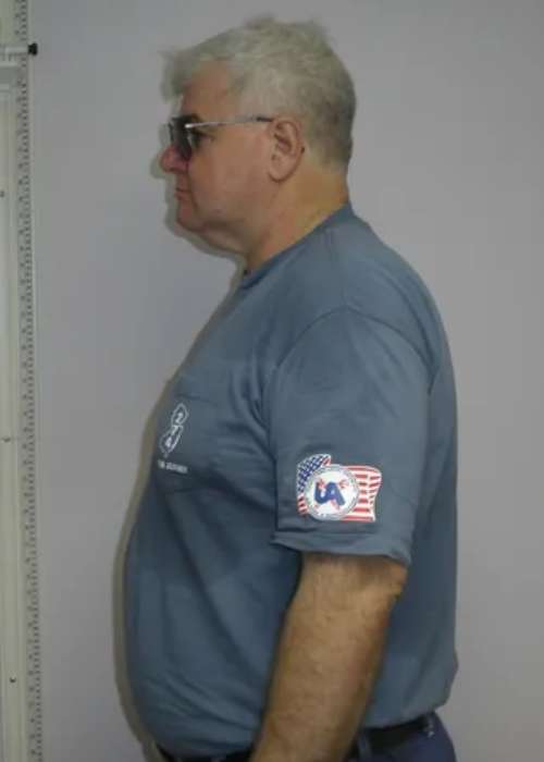 Tom's Success Story at The Institute for Weight Management & Wellness in Hackensack, NJ Tom's Success Story at The Institute for Weight Management & Wellness in Hackensack, NJ